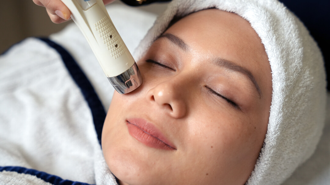Microneedling